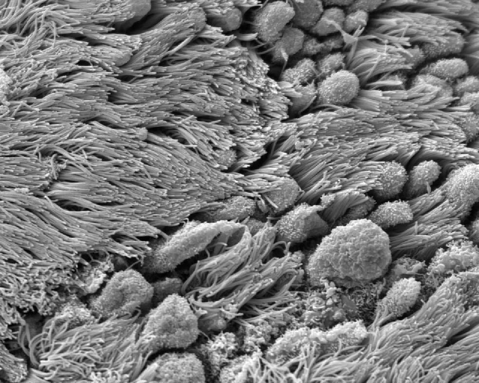 Výstelka vajíčkovodu, s množstvom pohyblivých riasiniek, v elektrónovom mikroskope
