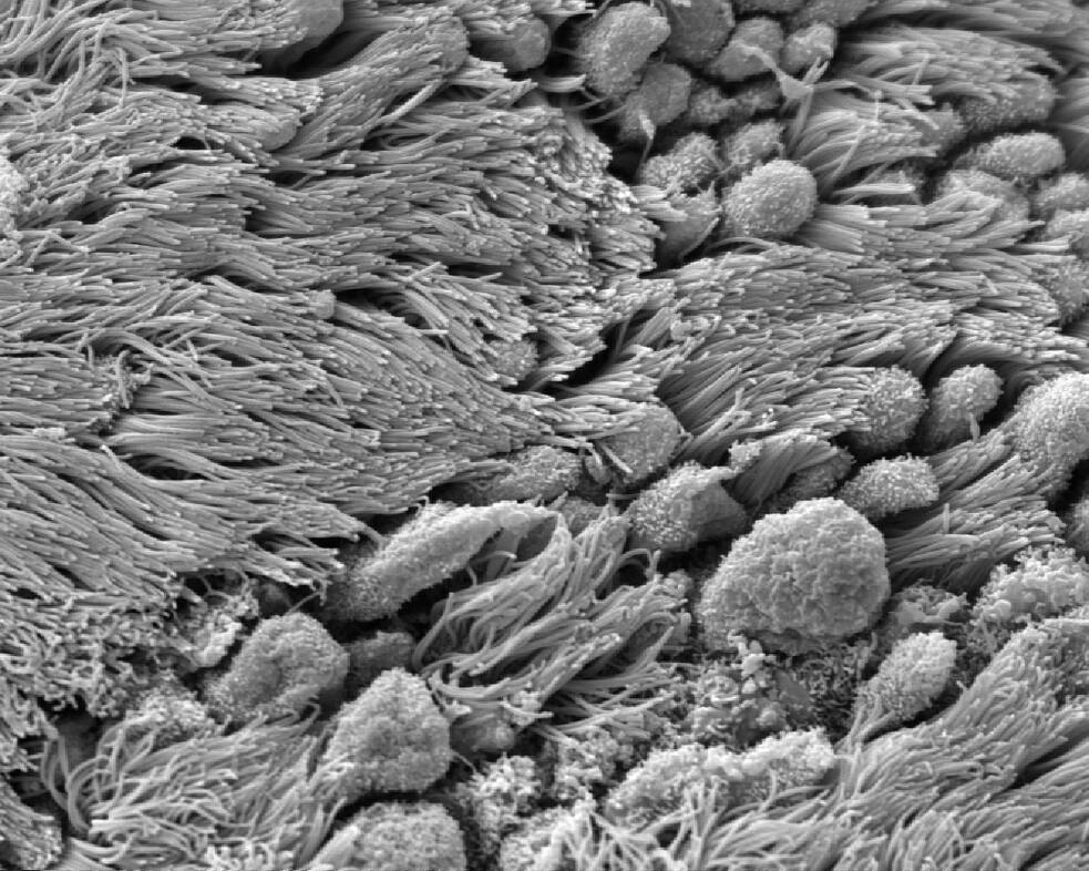 Innenwand des Eileiters mit vielen beweglichen Zilien durch ein Elektronenmikroskop gesehen