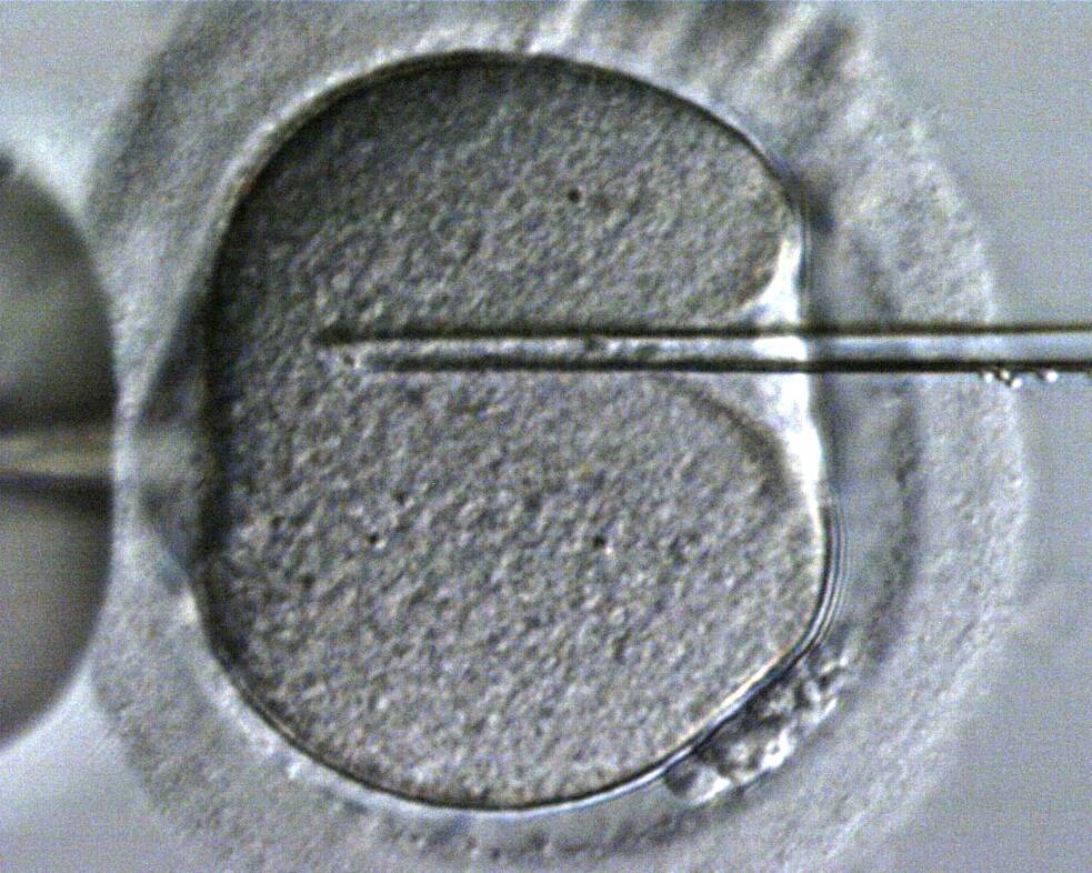 Künstliche Befruchtung durch Injektion einer Spermie in eine Eizelle