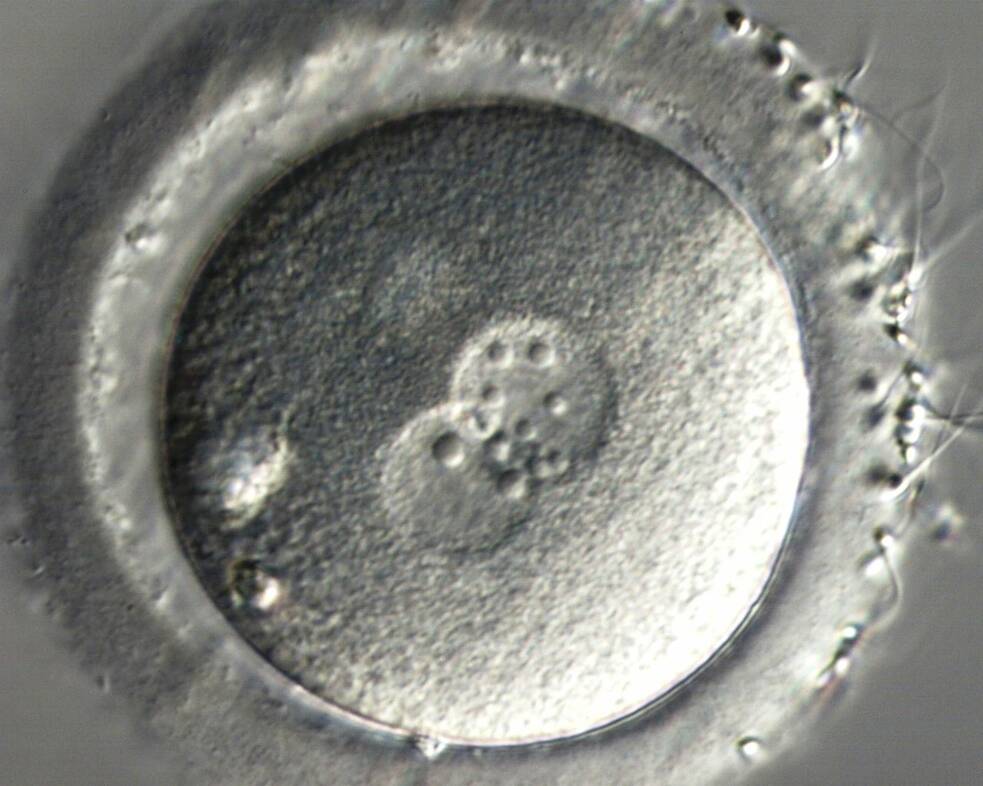 Der erste Tag nach der Befruchtung: In der befruchteten Eizelle kommt es zur Verknüpfung der genetischen Informationen von Mutter und Vater.