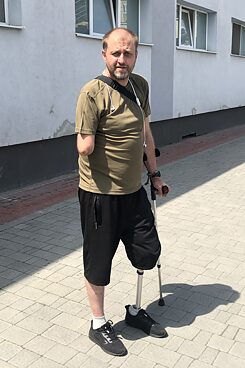 Вадим Фокс розповів, що як тільки-но отримав протез, сам навчився ходити з ним. Без допомоги фахівців. І за день вже проходить по два кілометри.
