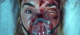Nahaufnahme von "Lena" (dargestellt von Kim Riedle als Protagonistin von "Liebes Kind"), die ihr zerschlagenes und zerschrammtes Gesicht unter einer Sauerstoffmaske zeigt.