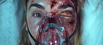 Nahaufnahme von "Lena" (dargestellt von Kim Riedle als Protagonistin von "Liebes Kind"), die ihr zerschlagenes und zerschrammtes Gesicht unter einer Sauerstoffmaske zeigt.