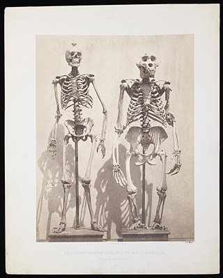 Roger Fenton, Skeleton of Man and of the Male Gorilla. London, ca. 1855